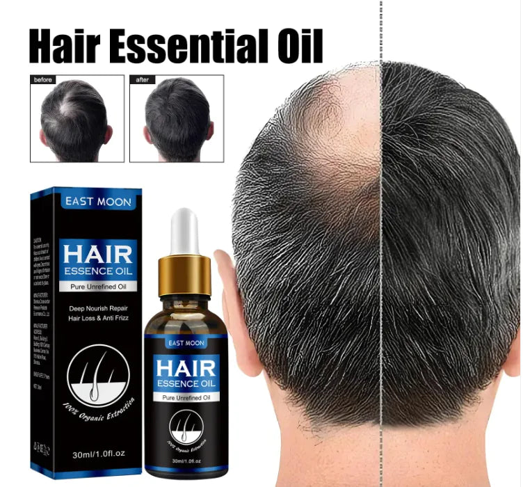 Men's Hair Growth Essence Men's Hair Growth Essence