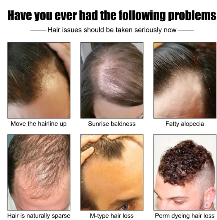 Men's Hair Growth Essence Men's Hair Growth Essence